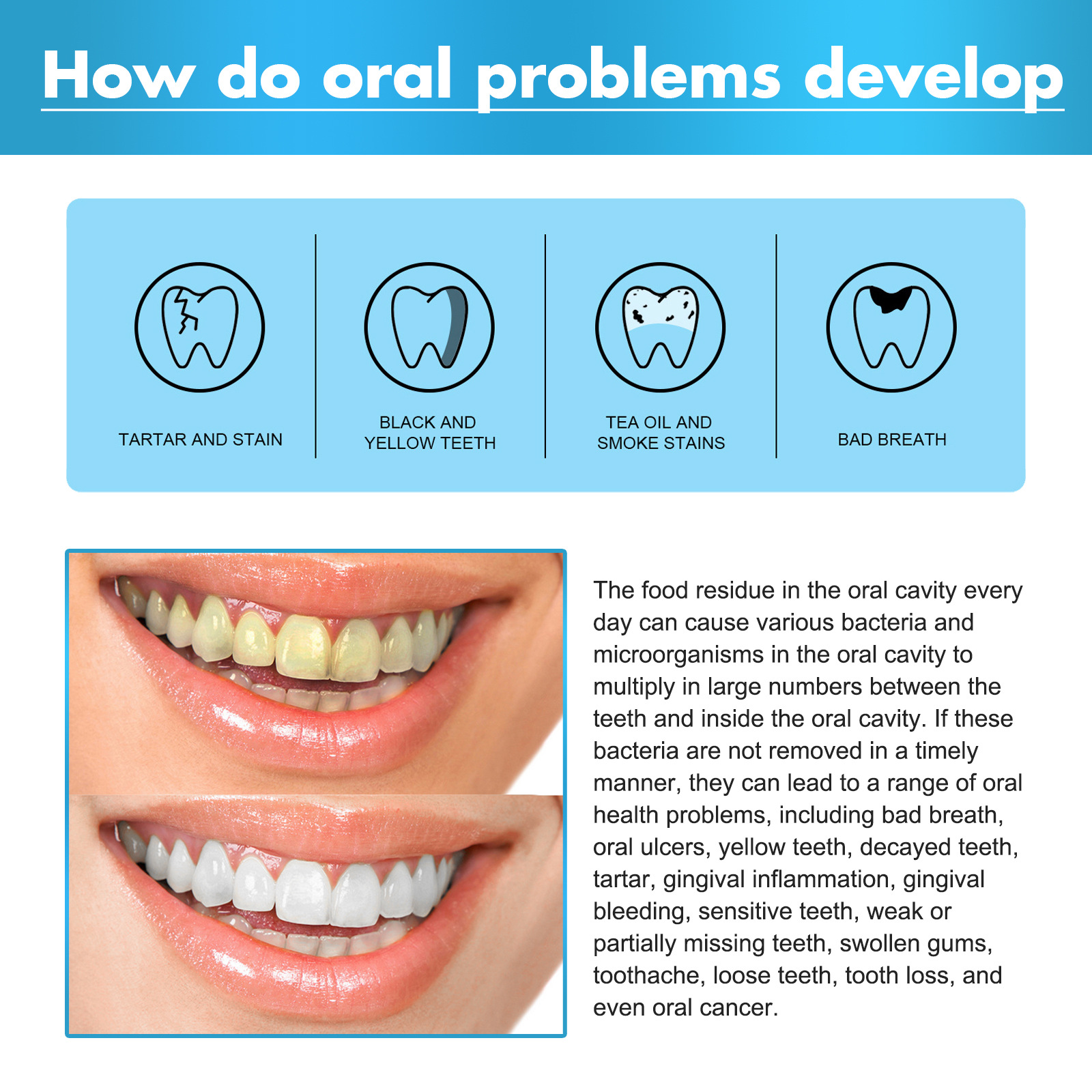 Herbal Toothpaste Mousse For Teeth Whitening And Oral Cleansing_voghion.com