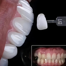 口腔器械全瓷贴面医疗美牙义获嘉蓝瓷VITA琥珀瓷美白修复护理