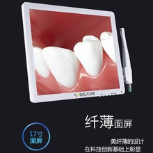 牙科口腔内窥镜17寸带显示器内窥镜一体机2000万高清像素拍照观察