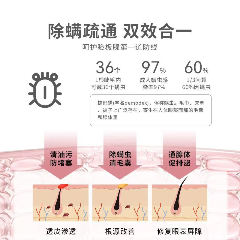 茶树精油除螨湿巾眼贴眼部专用4松油醇眼睛螨虫眼睑清洁眼干眼痒|undefined