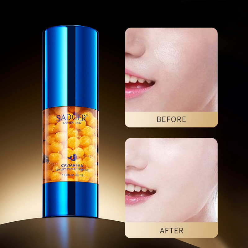 SADOER Caviar Hyaluronic Acid Luxurious Pearl Essence Nourishes Skin Moisturizing Hydration_voghion.com