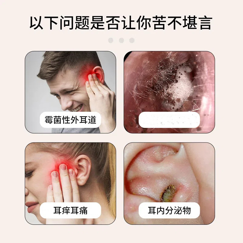 三草の2木のフルコナゾールは菌を抑えて耳を垂らします。|undefined