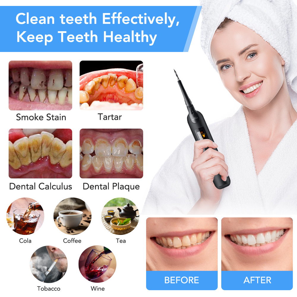 Smart Dental Equipment