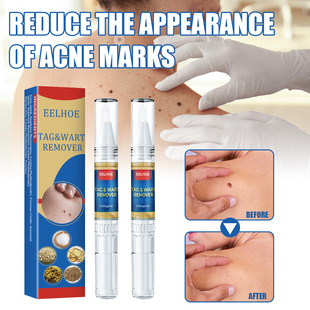EELHOE Skin Clover Mole Removal Pen Body Skin Mask Clover Removal Solution Skin Repair Care Solution