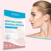 SEFUDUN祛疣贴Skin Tag Remover 平脖子疣 脸部疣 108PC跨境爆款