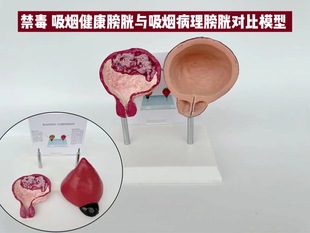 Bladder model bladder structure urination smoking harm health smoking bladder system pathology bladder anatomy model