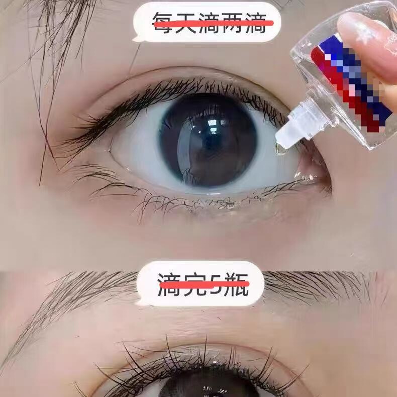 15ml Lutein Eye Drops to Relieve Eye Strain and Reduce the Appearance of Floaters 15ml Lutein Eye Drops to Relieve Eye Strain and Reduce the Appearance of Floaters