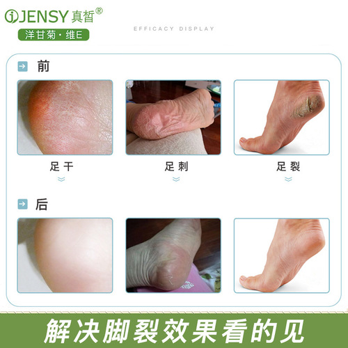 Onyan Chamomile Vitamin E Foot Cream Moisturizing and Moisturizing Foot Cream for Cracked and Peeling Skin Wholesale