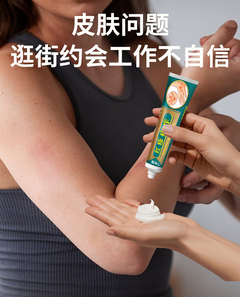 Yao Benren Skin External Discomfort Ointment Cream for Itchy Red Swollen Skin 20g specifications