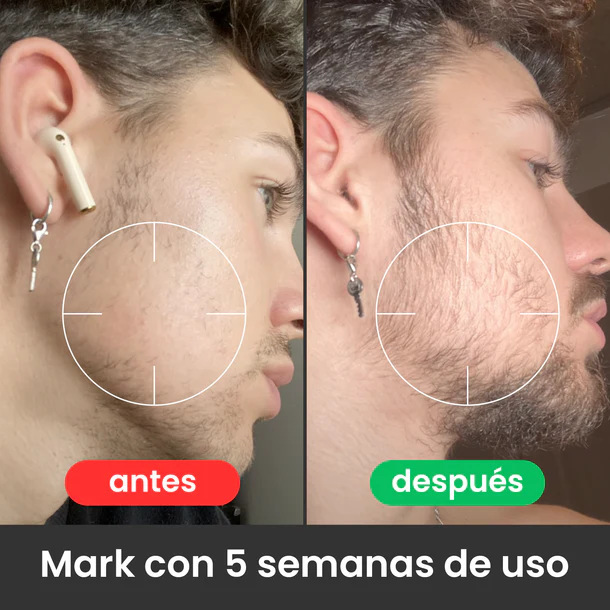 Bálsamo para Crecimiento de Barba Ultra Potente ヒゲ成長クリーム|undefined