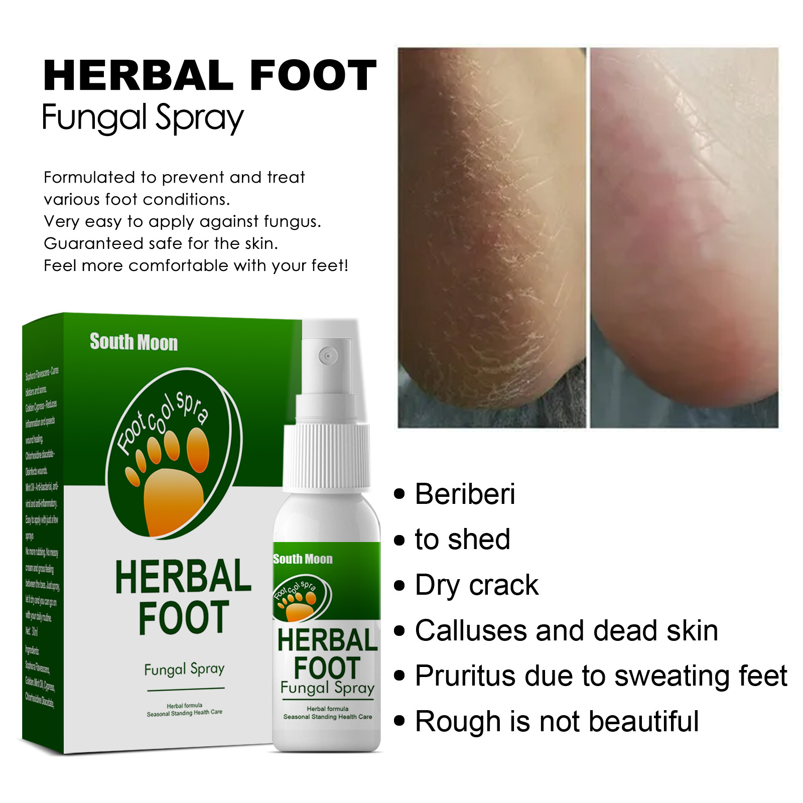 Herbal spray Sweat, Odor and Itch Relieving Foot Care Spray_voghion.com