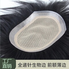 男性用ダブルニードル再発行ブロック、手織り生頭頂部ハゲ男性用ウィッグ、額用インビジブルバイオスカルプ