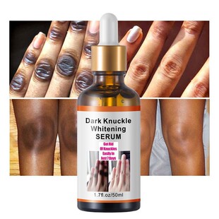 �羳�ֲ���ָ�P��ȥ���������AҺ Dark Knuckles Whitening S eru