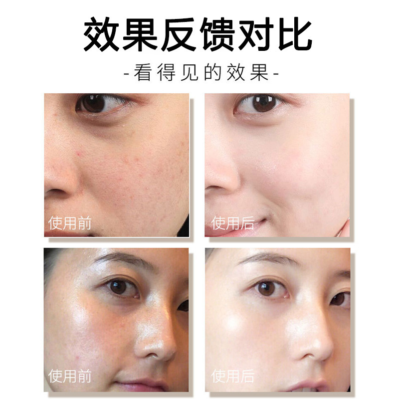 胶原蛋白填充粉批发去抬头纹法令纹填充凹陷皱纹冻干粉VC填充粉霜|undefined