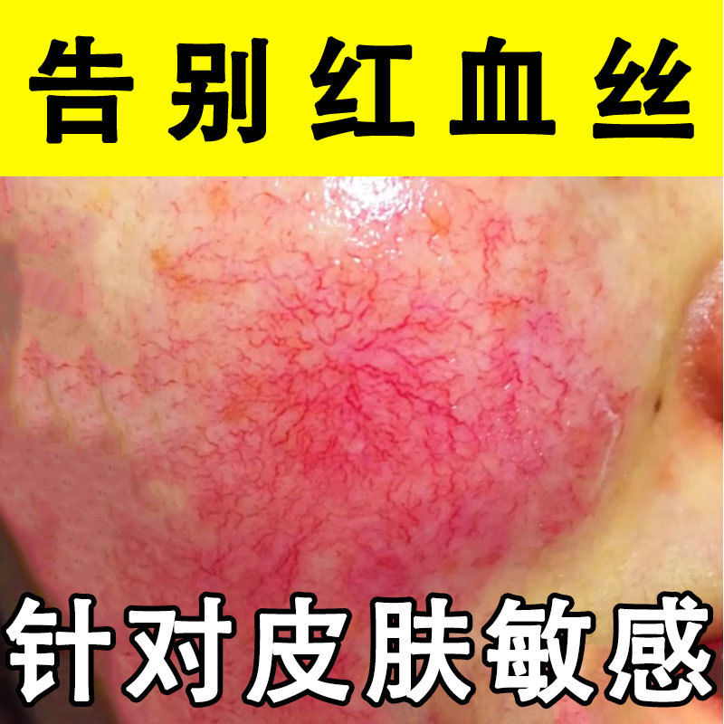 积雪草修复精华液修复敏感肌增厚角质层激素脸修复去红血丝精华液