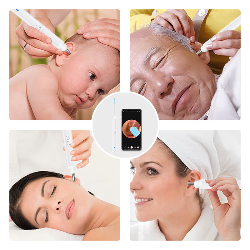 Smart Visual Ear Pick with Light High Definition Ear Cleaner Connects to Mobile Phone Luminous Earwax Removal Tool_voghion.com