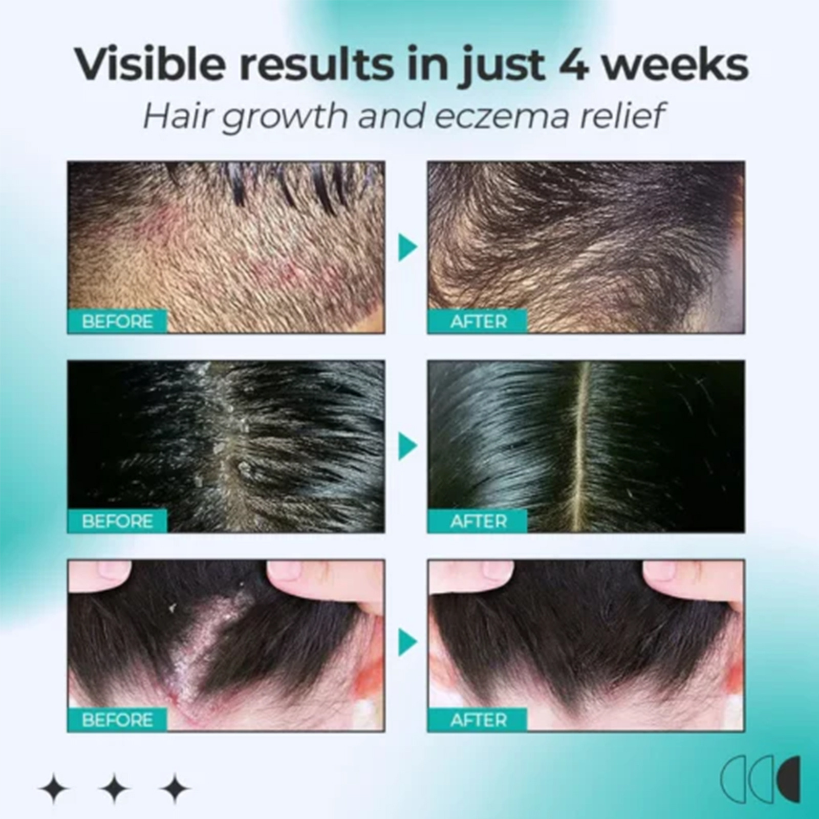 for EELHOE care cleaning scalp relieving itching, refreshing the skin, moisturizing and preventing peeling rol_voghion.com