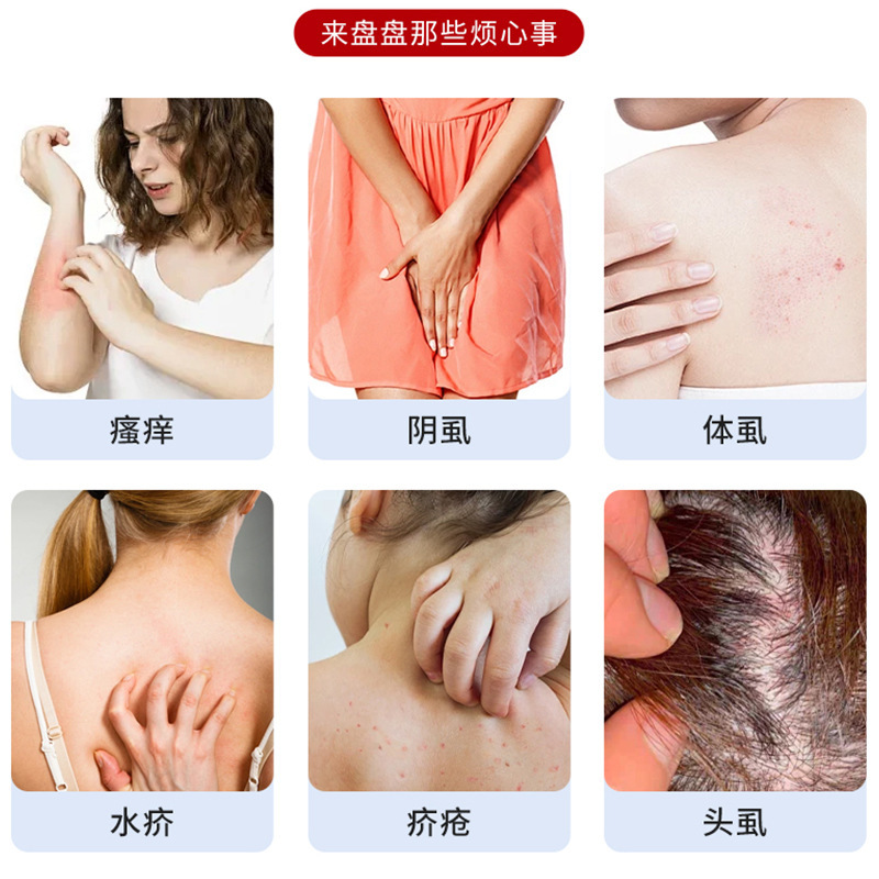 现货批发泰国邦霸虱疥一喷灵舒缓肌肤瘙痒体虱阴虱头虱不适保健液|undefined