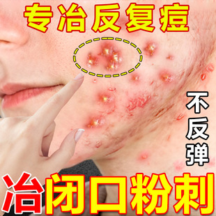 ����AҺ�ӡ�]�ڷ۴����o�ഺ�����տsë������Ժ�ݱ��ˮ