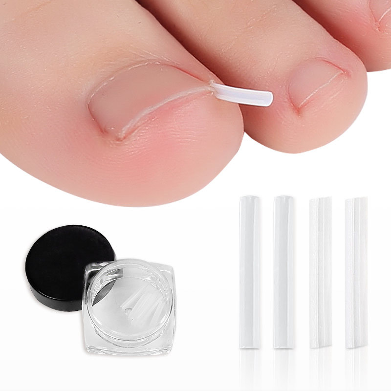 nail correction device nail inlay filling pad nail groove toenail long meat filling strip nail correction pad nail correction wire device
