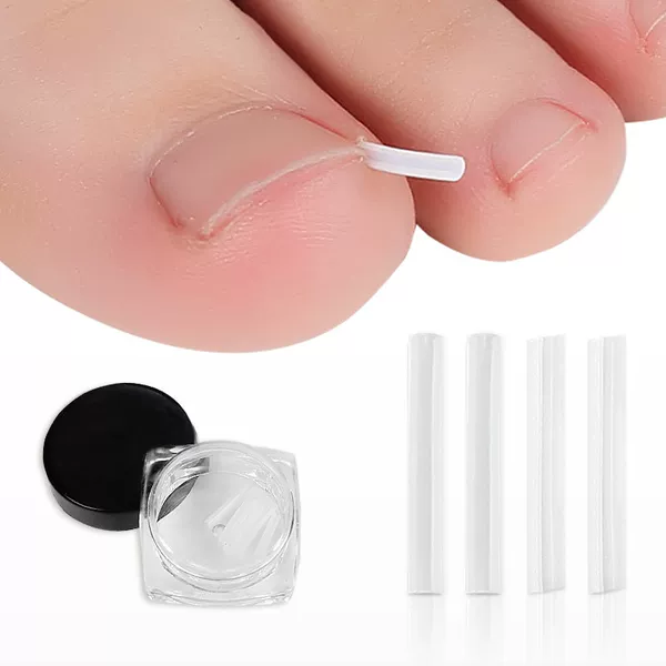nail correction device nail inlay filling pad nail groove toenail long meat filling strip nail correction pad nail correction wire device