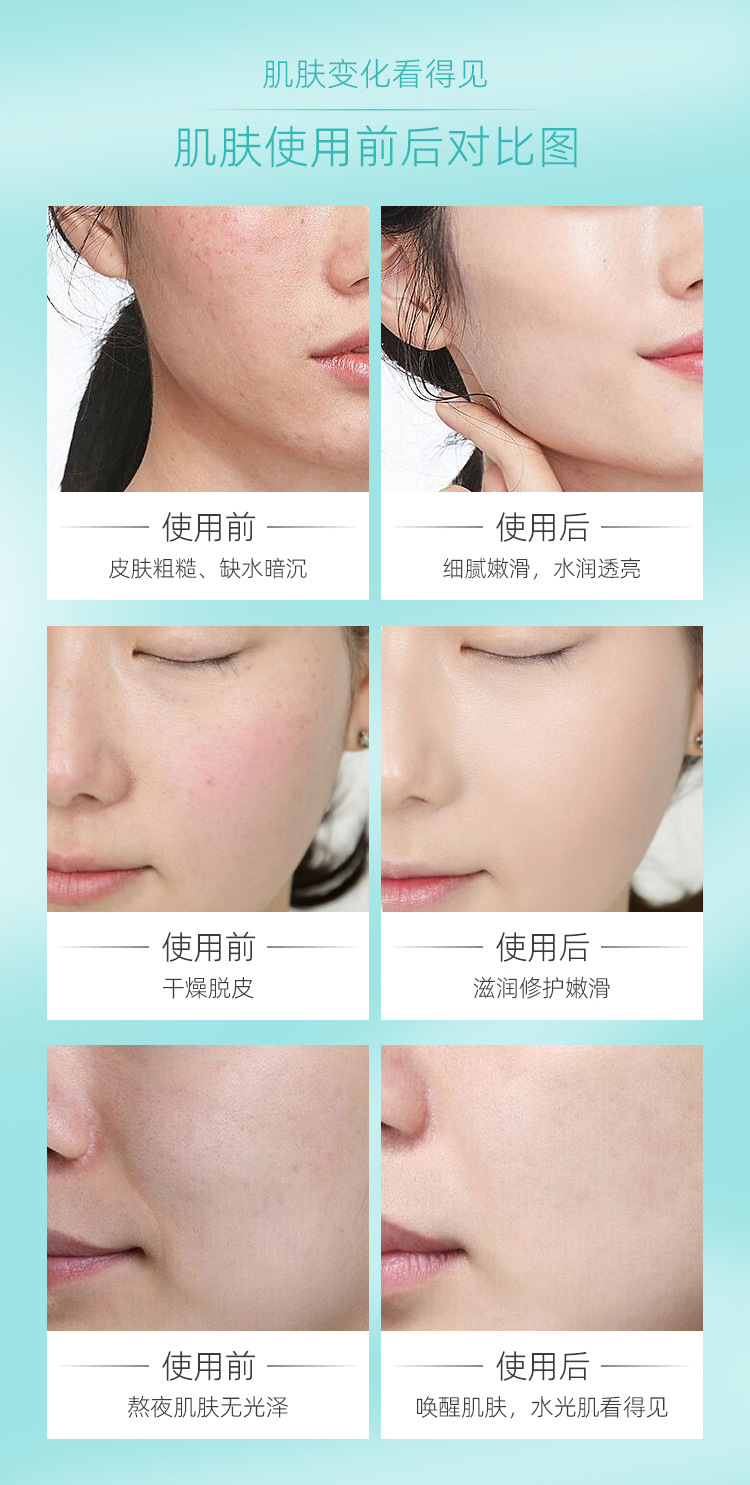 BAICOCO玻尿酸肌底舒护精华液_07