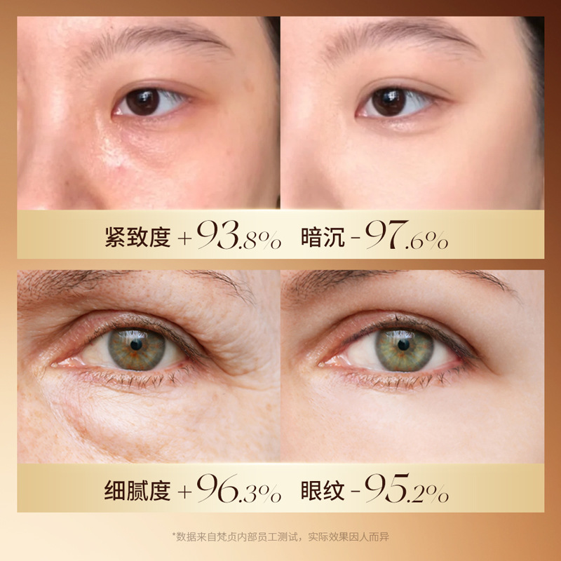Crema para los ojos con nitricotinamida VC, hidratación y humectación, mejora las líneas alrededor de los ojos, mejora la belleza alrededor de los ojos, crema para los ojos genuina al por mayor.