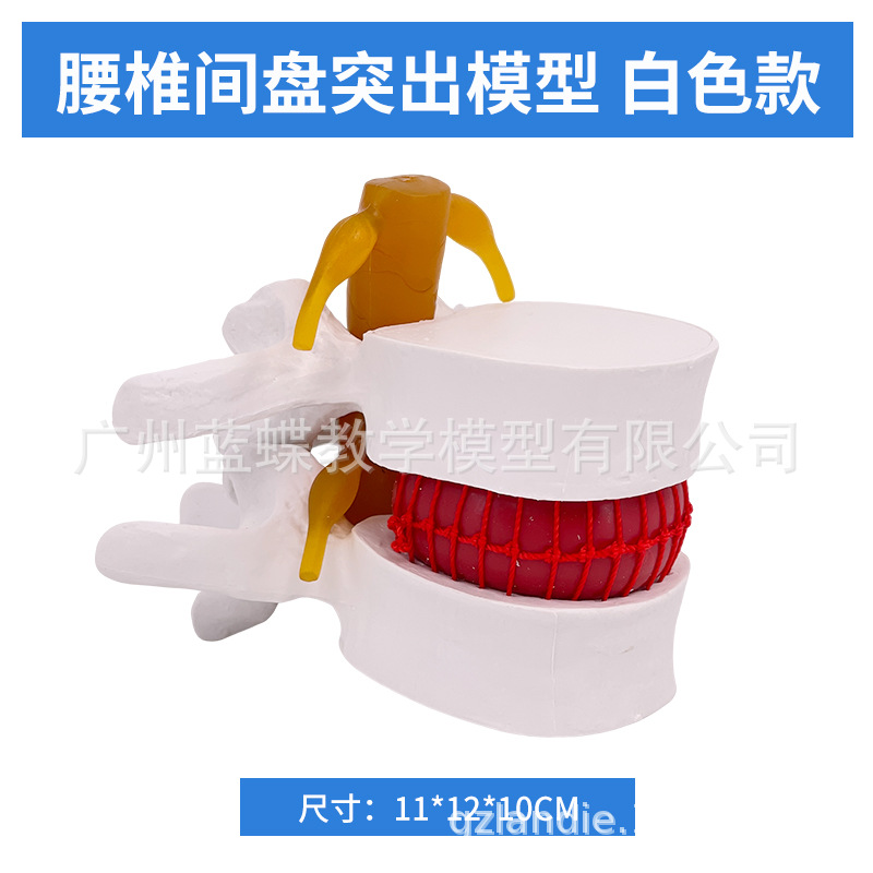 ׵����ģ����Ʒҽѧ������׵ͻ��������׵�ǲ�����ʾ�ؽڱ�׼ģ��