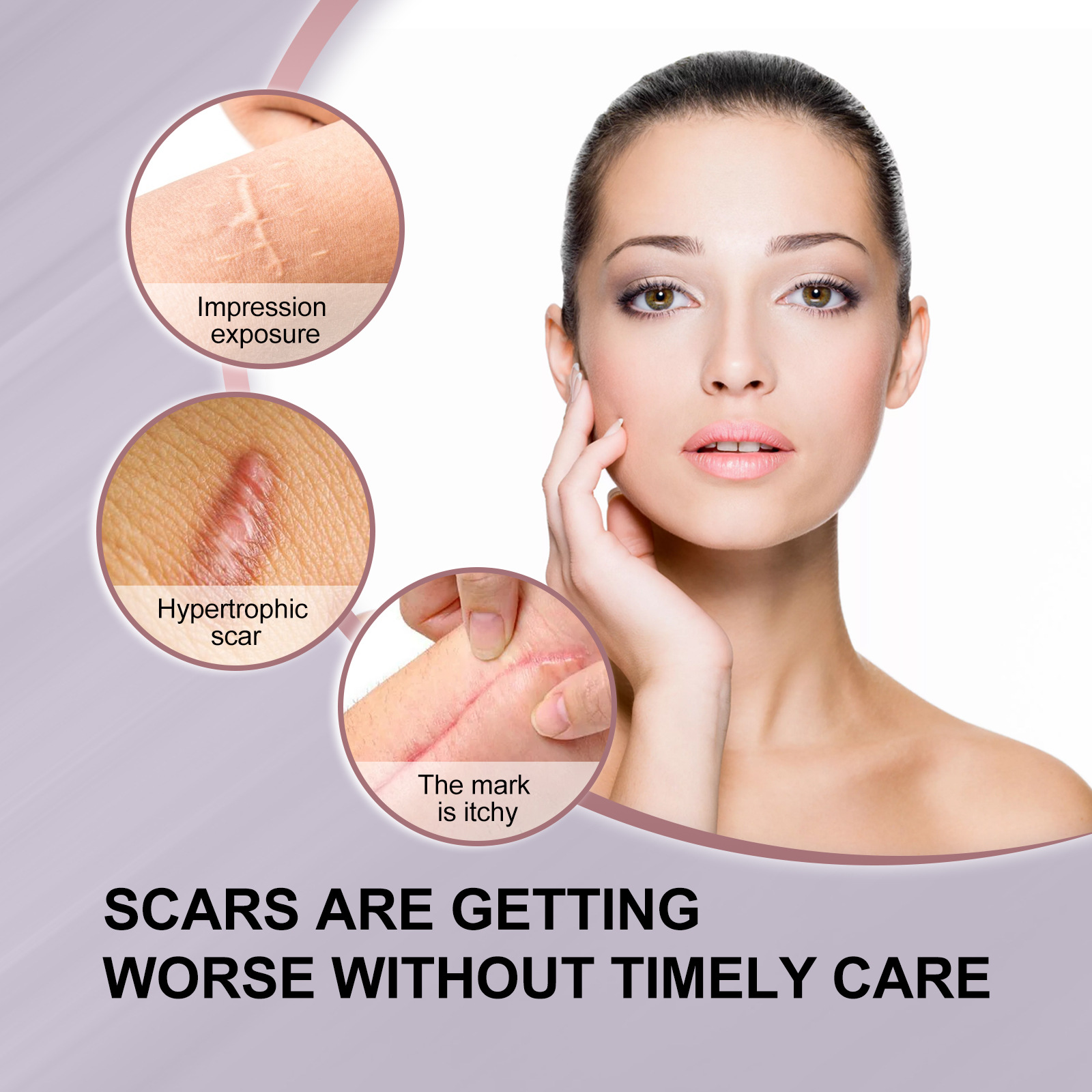mars Squalane+Vitamin E Rose Fruit Oil to Desalinate Surgical and Remove Burn Marks from Cesarean Section Scars_voghion.com