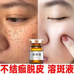 无创溶斑液不脱皮淡斑精华液美容院去雀斑黄褐斑真皮斑晒斑祛斑液