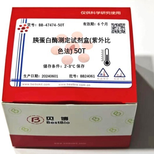 Bestbio贝博 谷草转氨酶（GOT)检测试剂盒(分光光度计) BB-47472