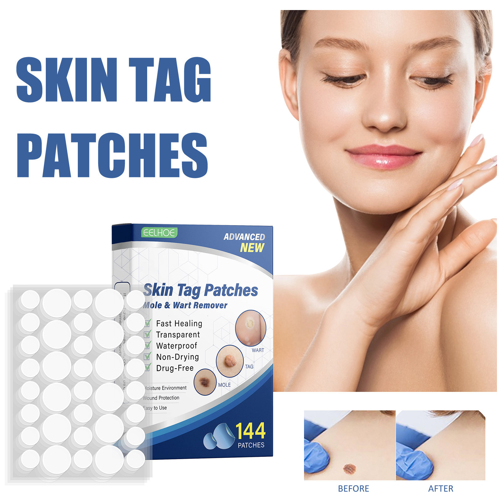 Eelhoe Skin Tag Remover Patch for Cleaning and Care of Skin Tags, Moles, and Black Moles