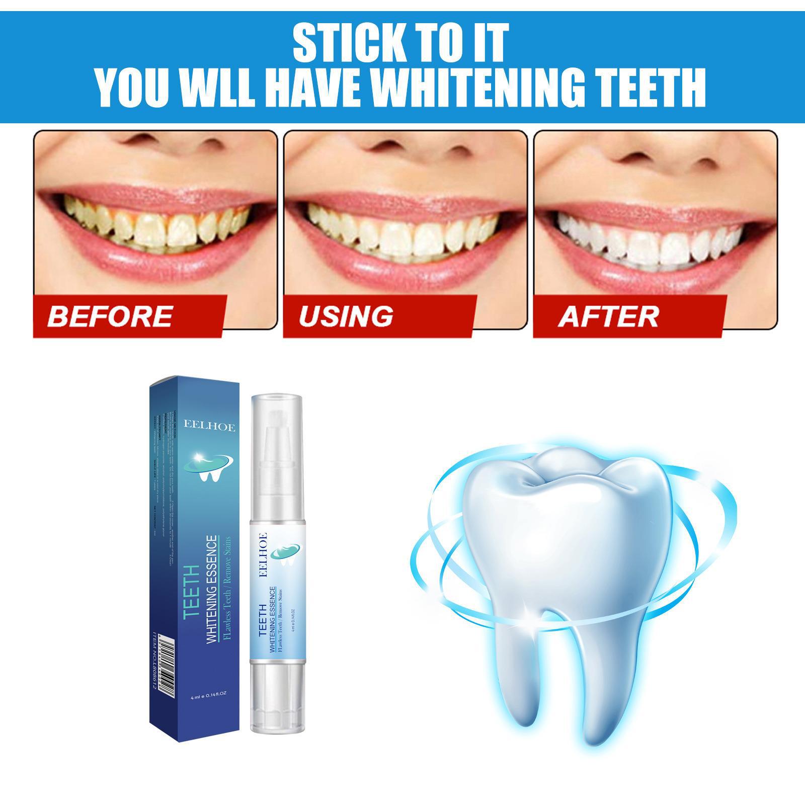 Teeth Cleaning Pen Image 4