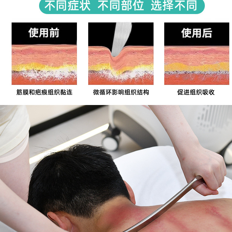 专业级筋膜刀医用不锈钢大刀多功能刮小腿放松肌肉颈膜刀自用|undefined