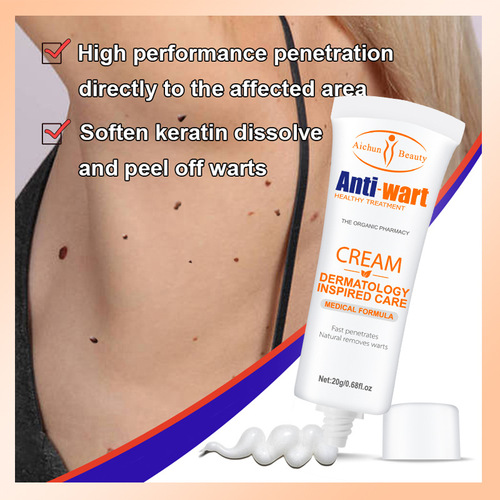 Cross-border Southeast Asia anti-wart cream hydrating and moisturizing foot and neck face and body care wholesale Anti-wart cream