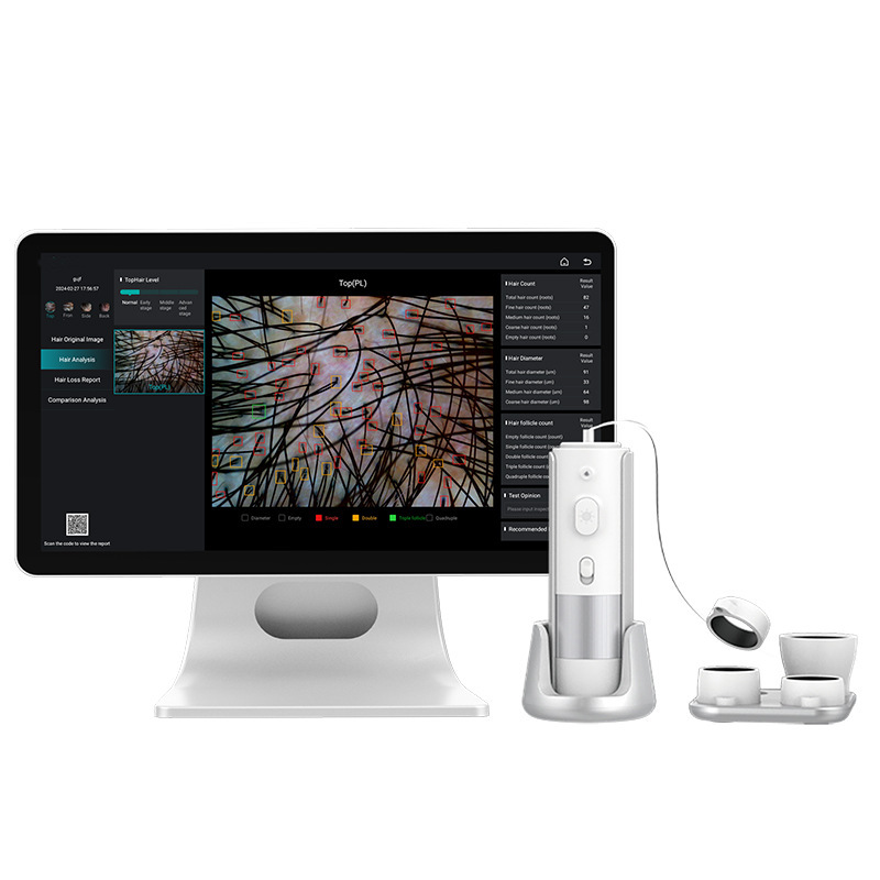 Professional Scalp analyzer Scalp diagnosis head skin care|undefined