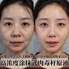 涂抹式类肉毒杆肉毒原液抗皱紧致精华液去抬头细纹多肽肉毒精华液