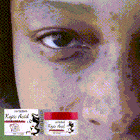 Jayswing kojic acid can lighten spots, repair the dark, white, brighten, wrinkle resistant and rejuvenating face cream_voghion.com