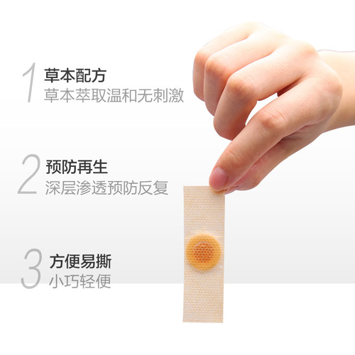 Nanjing Tongrentang Lejia Old Shop Corns Patch Corns Ointment Flesh Pricks Calluses Foot Care Corns Plaster