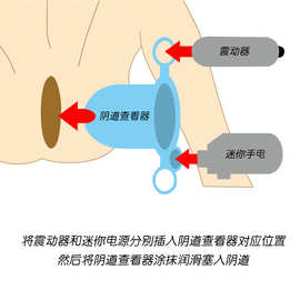 震动刺激照明窥阴器扩阴器女用扩宫窥器成人情趣性用品阴道扩张器