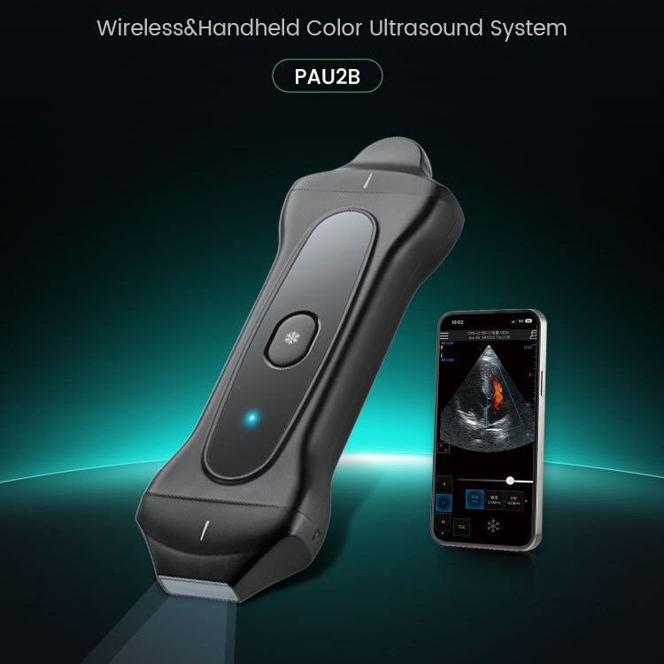 普迈思外贸款手持式超声检测仪PAU2B儿童无线超声波设备