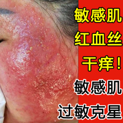 雪草原液体保湿、保湿、修復、敏感肌ホルモン、顔の赤み、乾燥、かゆみ、角質層の増粘エッセンス