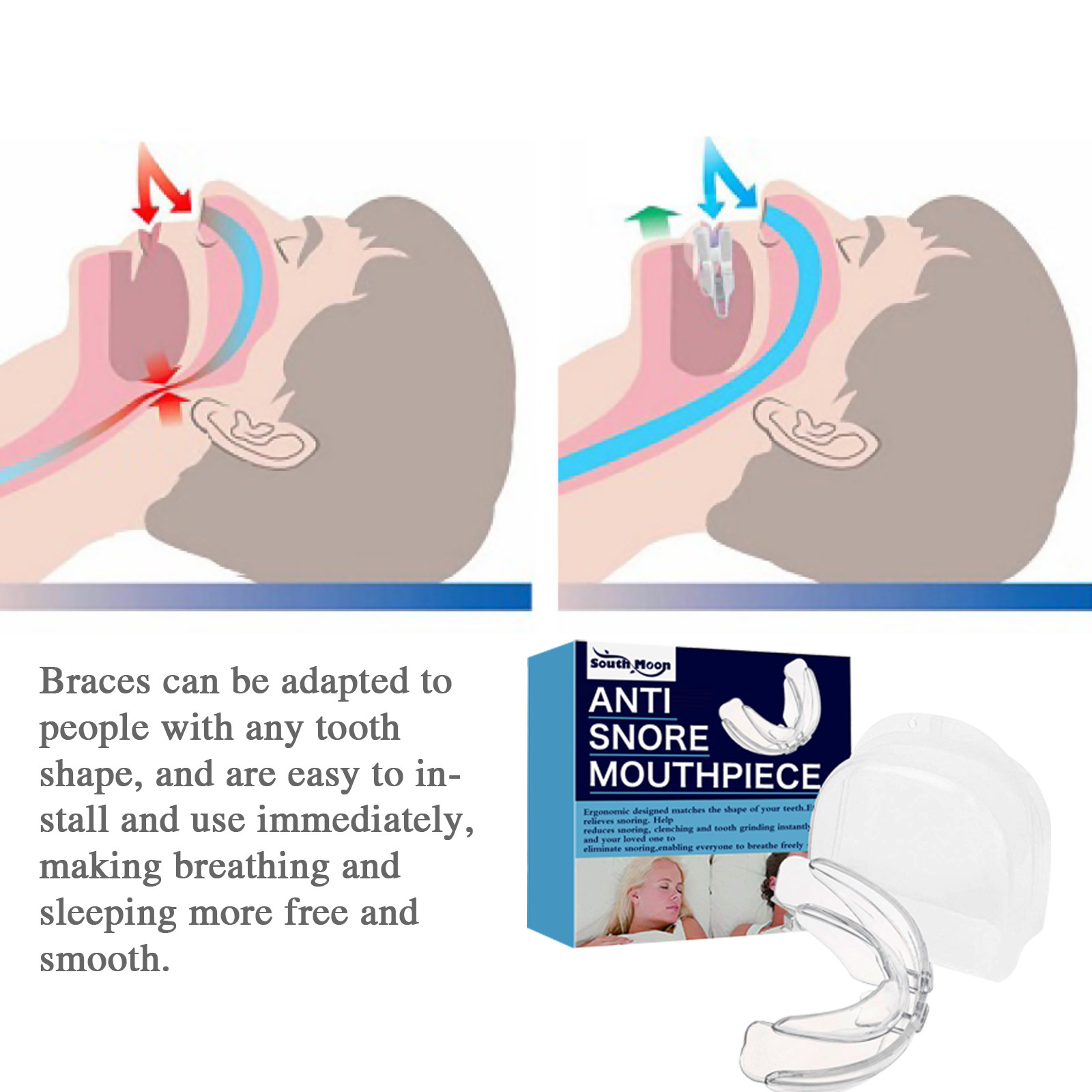 South Moon Anti-Schnarchen Mondbeschläger, Anti-Schnarchen Mondbeschläger, Zännbeschläger a Schutzmondbeschläger_voghion.com