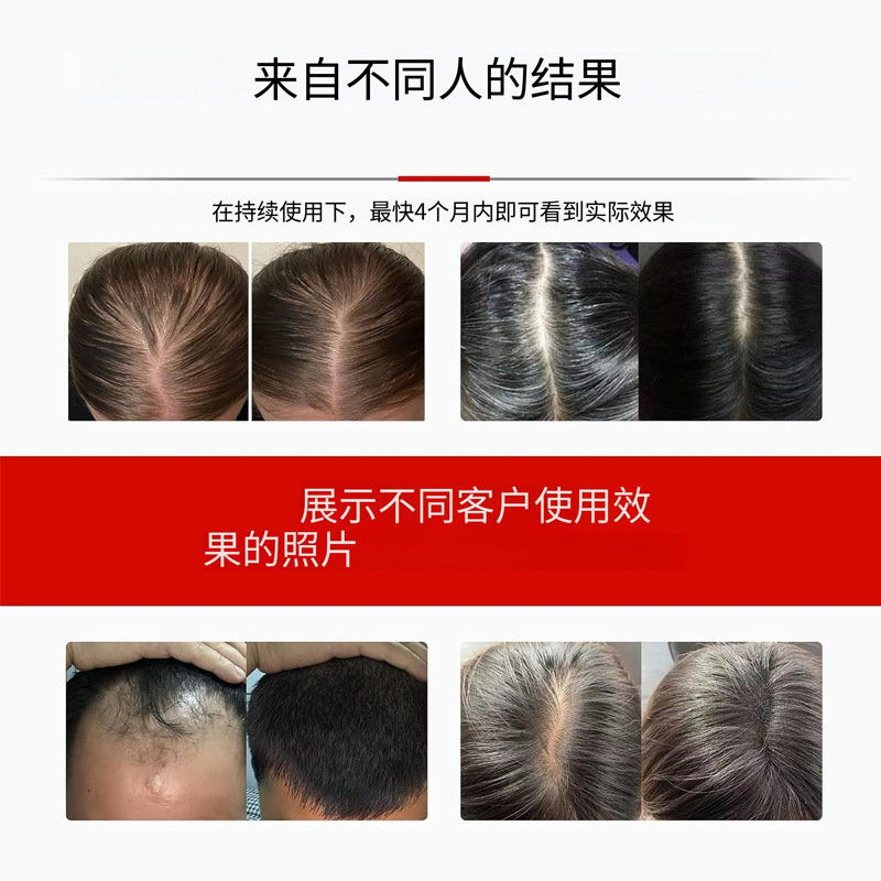 跨境新款红光生发帽 红外线理疗便捷式充电生发仪育发红光理疗仪|undefined