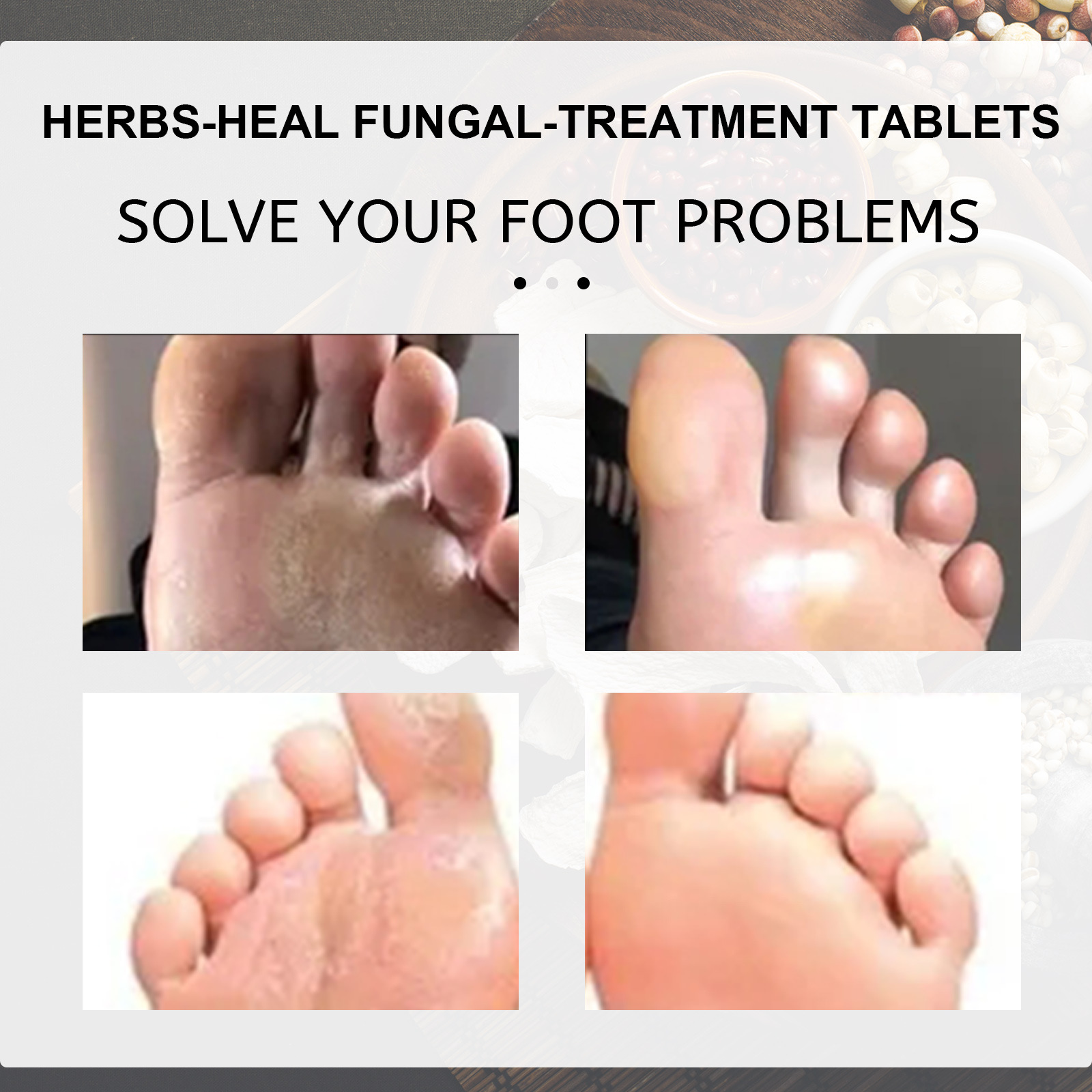 Eelhoe Bath Old Ginger Tabletten zum Vertreiben von Kälte und Entfernen von Feuchtigkeit, Reparatur grauer Nägel, Einweichtabletten, Fußpflege_voghion.com