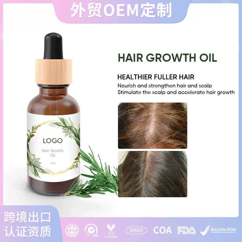 跨境美区爆品OEM育发油头皮修复发油防脱发乳液Hair Growth Oil