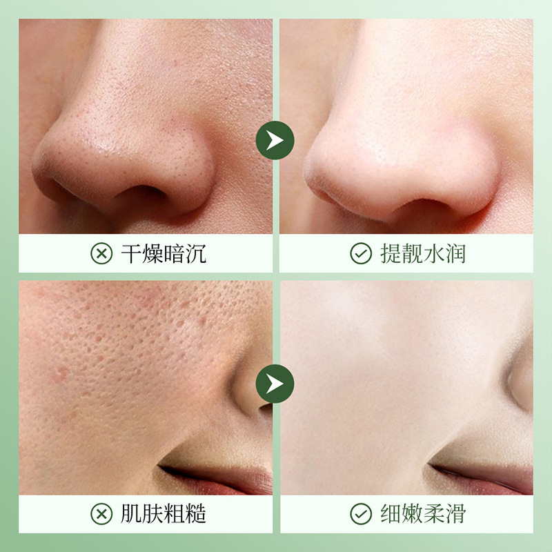 Limpieza facial limpia de poros con ácido salicílico superior, limpieza y cuidado de la piel, limpieza facial limpia de poros finos para mejorar los puntos negros, crema facial
