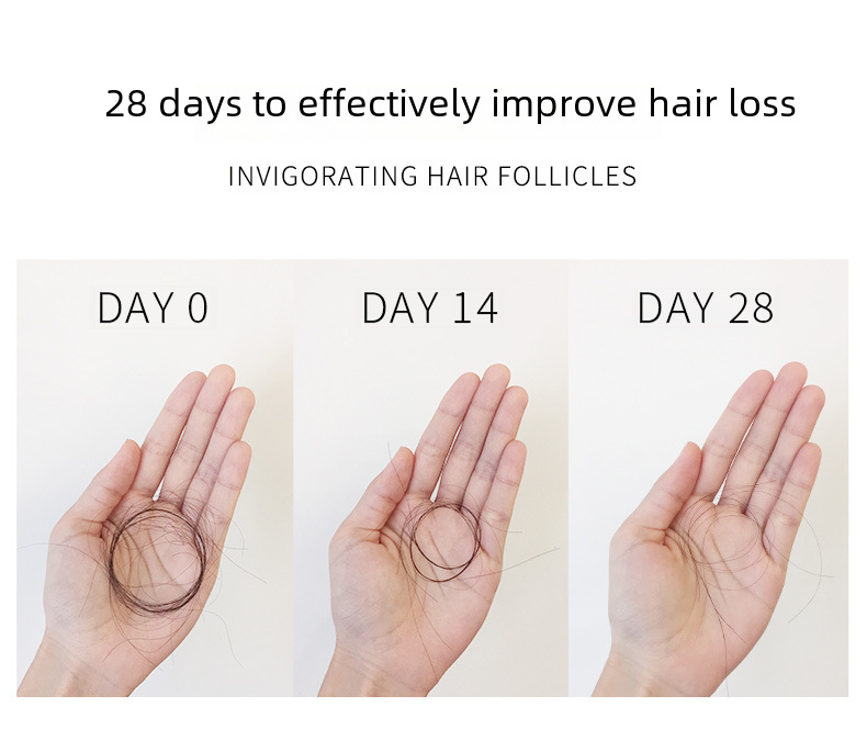 Ginger Shampoo Scalp Health