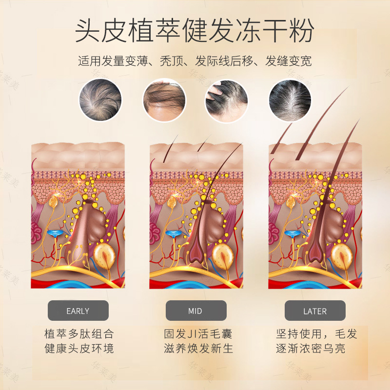 脱育発液首烏密発毛毛包活性栄養液健発冷凍乾燥粉頭皮栄養成長液