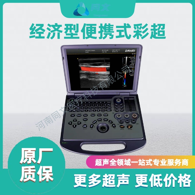 Ecógrafo portátil económico, ecógrafo portátil tipo B, máquina de ultrasonido, precio negociable para uso médico